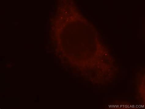 MMP1 Fusion Protein Ag25073 | Proteintech