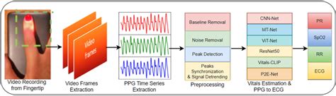 Image result for Graphical Summary