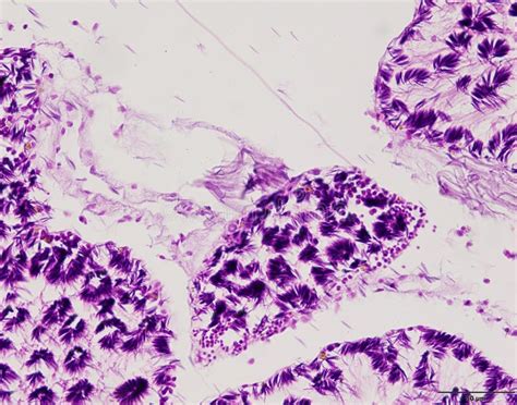 Image result for Tissue Sample Drawing Under Microscope