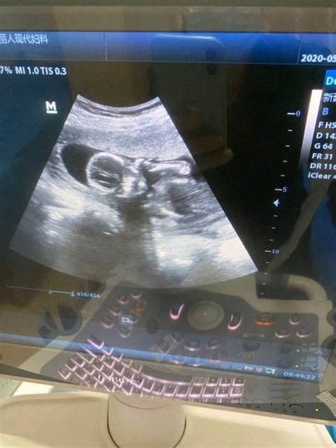 16周胎儿多大,17周胎儿真实图片 - 伤感说说吧