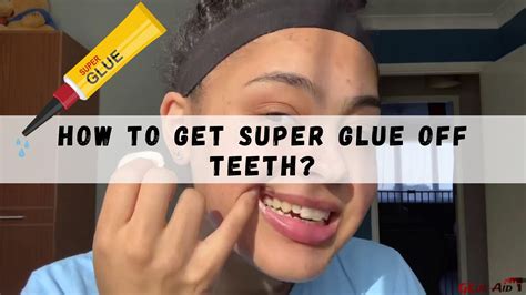 How To Glue A Loose Tooth at Jeremy Tellez blog