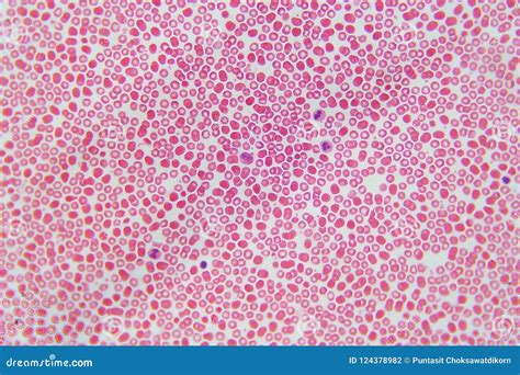Blood Cells Under Microscope View for Education Stock Photo - Image of ...