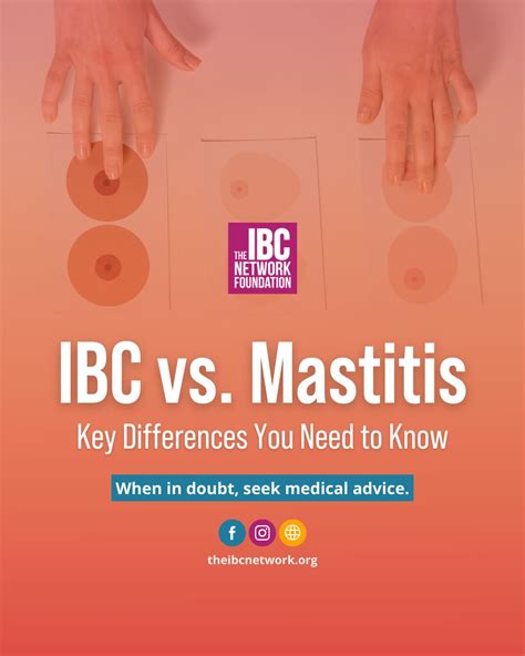 It's important to know the difference between Inflammatory Breast Cancer (IBC) and a breast ...