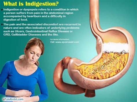 what is indigestion and how it is treated - Brainly.in
