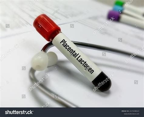 Blood Sample Human Placental Lactogen Hpl Stock Photo 2173198123 ...