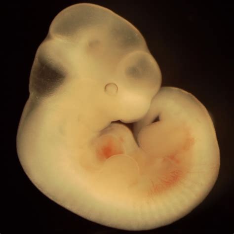 Spatial Transcriptome Mouse Embryo Development 的图像结果