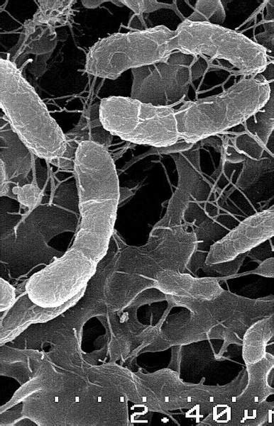 what is chemosynthesis? Do not cheat please - Brainly.in