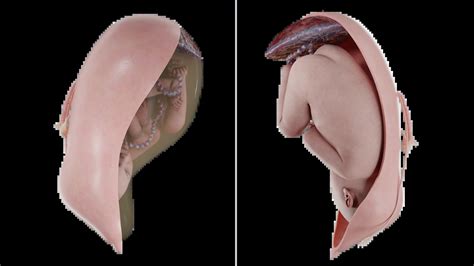 Longitudinal, Transverse, Oblique Fetal Position: Diagnosis, Complications, Management of Labor ...