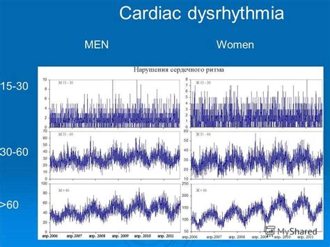 Basic Dysrhythmia Practice Test 的图像结果