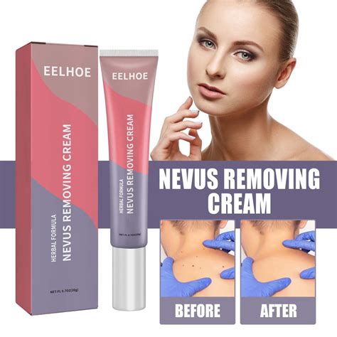 EELHOE Mole Removal Cream Skin Cleansing Mole Removal Cream | 蝦皮購物