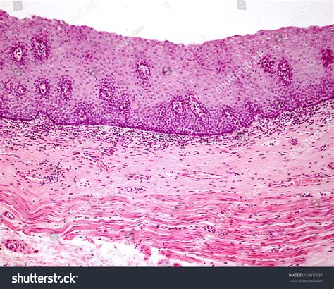Stratified Squamous Epithelium Keratinized