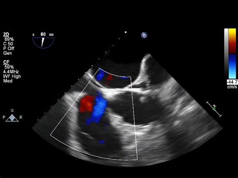 Dr. Srikant Ku Swain | Best Neurosurgeon & EndoSpine Surgeon in Bhubaneswar