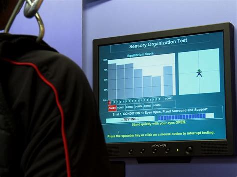 Image result for Computerized Dynamic Posturography