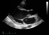 echo in Greek - English-Greek Dictionary | Glosbe