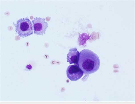 Image result for Diff Quick Stain