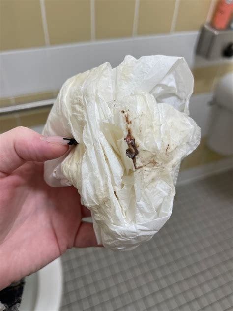 Thick brown mucus pic included need opinions please | BabyCenter