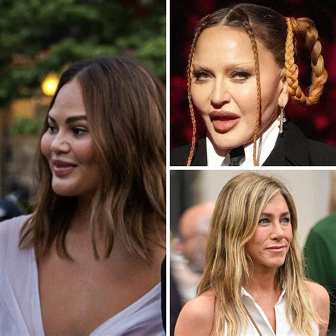 'Pillow Face' is the Latest Celebrity Cosmetic Surgery Fail! Check it Out!