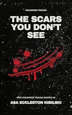 The Scars You Don't See: How Childhood Trauma Shapes Us eBook ...
