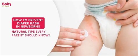 How to Prevent Diaper Rash Naturally in Newborns | BabyOrgano