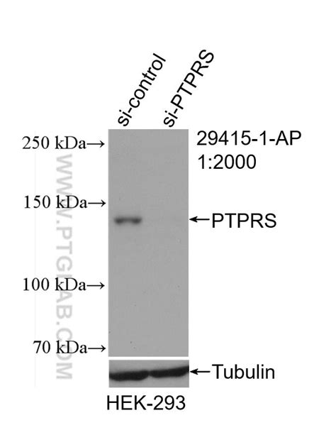 PTPRS antibody (29415-1-AP) | Proteintech
