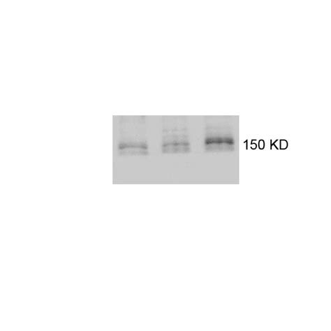 TBC1D1 antibody (22124-1-AP) | Proteintech