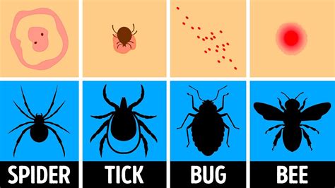 Image result for Bug Bite Identification Chart