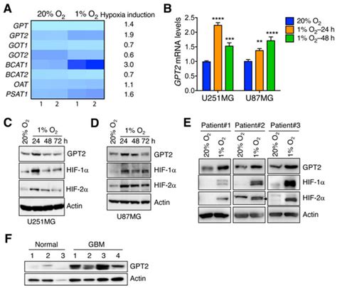 GPT2 Is Induced by Hypoxia-Inducible Factor (HIF)-2 and Promotes ...