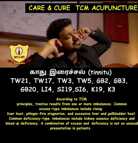 Acupuncture | Acupuncture courses | Academy of Acupuncture | Care and ...