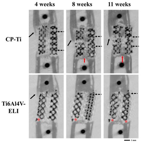 Bone Regeneration in Critical-Sized Bone Defects Treated with ...