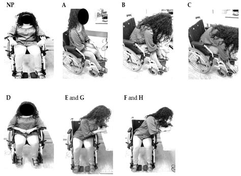 Wheelchair Pressure Ulcer Prevention Using FBG Based Sensing Devices