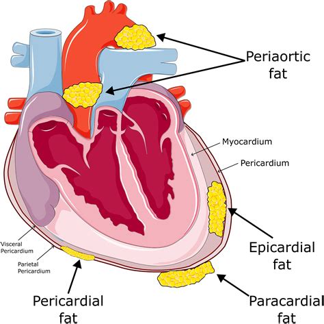 Epicardial fat and ventricular arrhythmias - Heart Rhythm