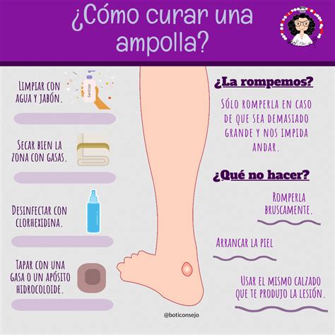 Consejos para las ampollas - ¿Cómo curarlas? - Boticonsejos