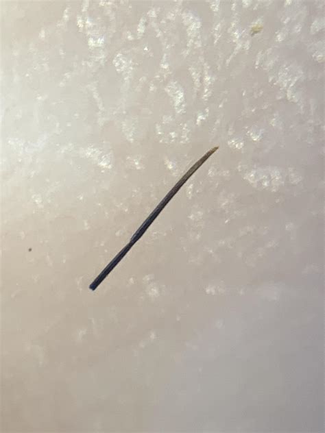 Image result for Hair Splinter Infection