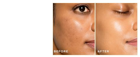 Hyphen 18% Brightening + 20% Collagen Face Serum | Double Shot Serum ...