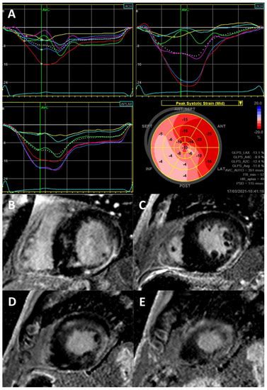 Fabry Disease and the Heart: A Comprehensive Review