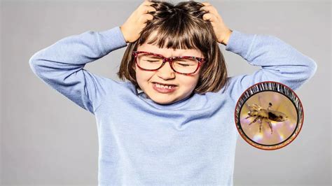 Anti Lice Hair Oil: உங்க தலையில் பேனும் ஈறும் கொட்டிக்கிடக்கா, இந்த ...