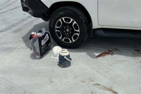 Image result for Run Over Accident