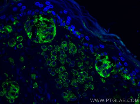 CD63 antibody (25682-1-AP) | Proteintech