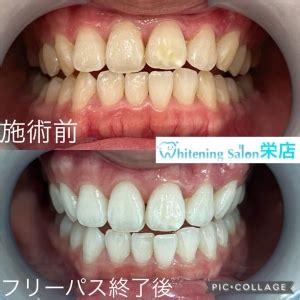 Image result for System32.dll Problem