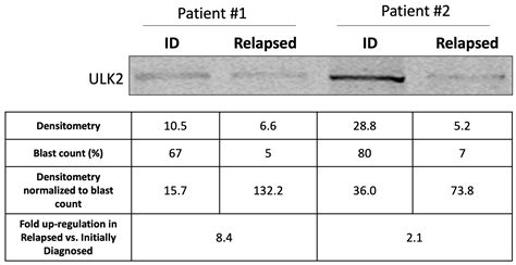 ULK2 Is a Key Pro-Autophagy Protein That Contributes to the High ...