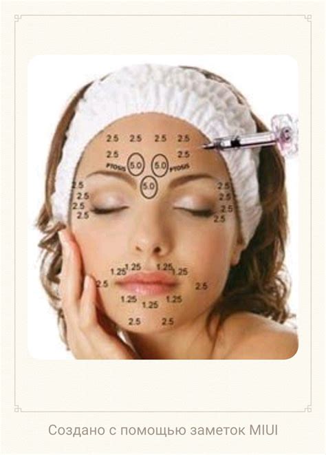 Image result for Botox Injection Patterns