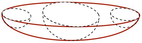 Design Specifications for an Auxiliary Incision Retractor in ...