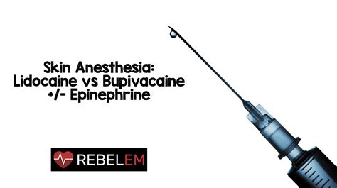Skin Anesthesia: Lidocaine vs Bupivacaine +/- Epinephrine - REBEL EM ...