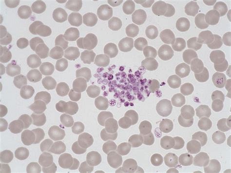 Platelet aggregate - HORIBA