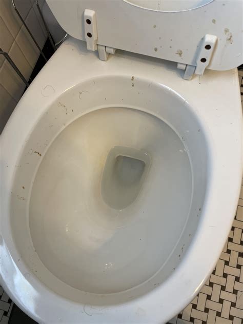 Image result for Exploding Diarrhea