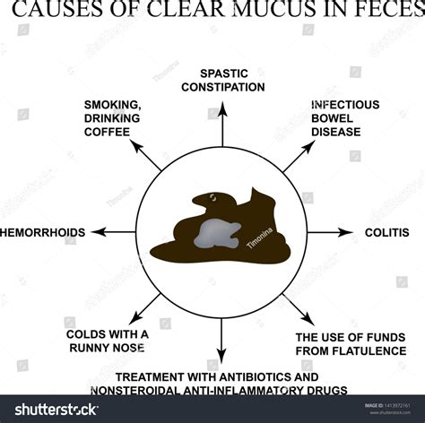 White Mucus In Stool