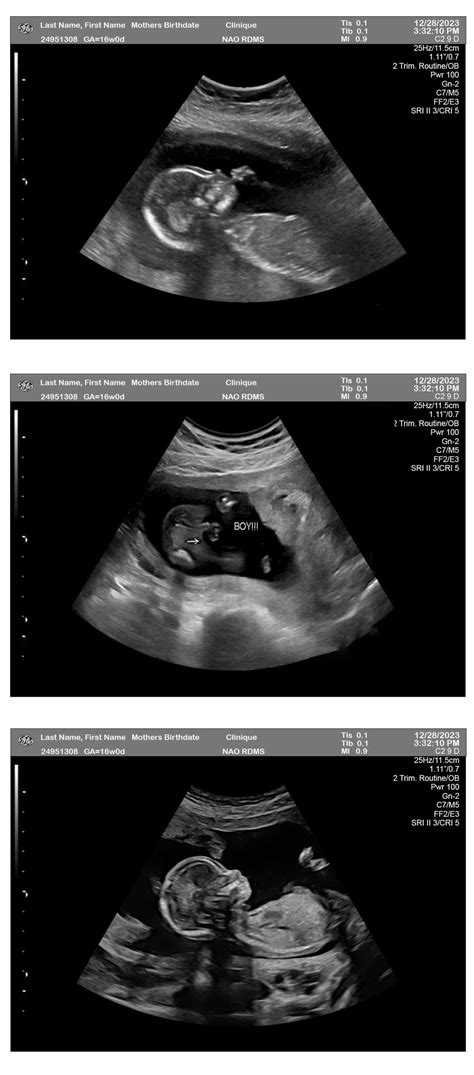 Are Baby Boy Fetuses Bigger at Chloe Maygar blog