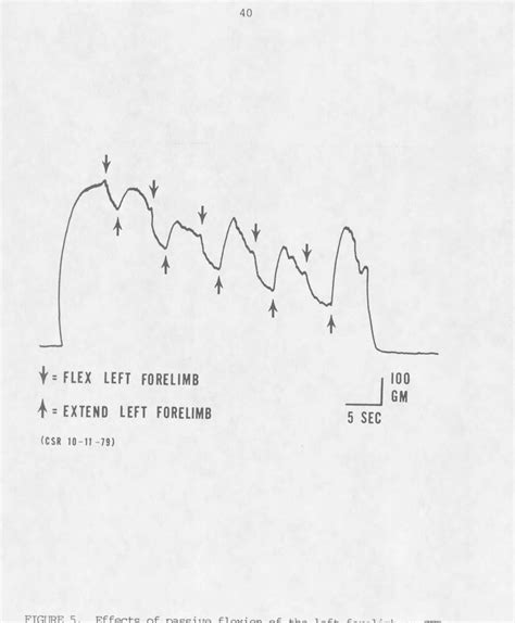 Image result for Crossed Extensor Reflex