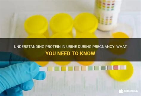 Understanding Protein In Urine During Pregnancy: What You Need To Know ...