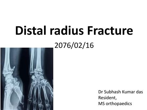 Image result for Open Reduction Distal Radius Fracture